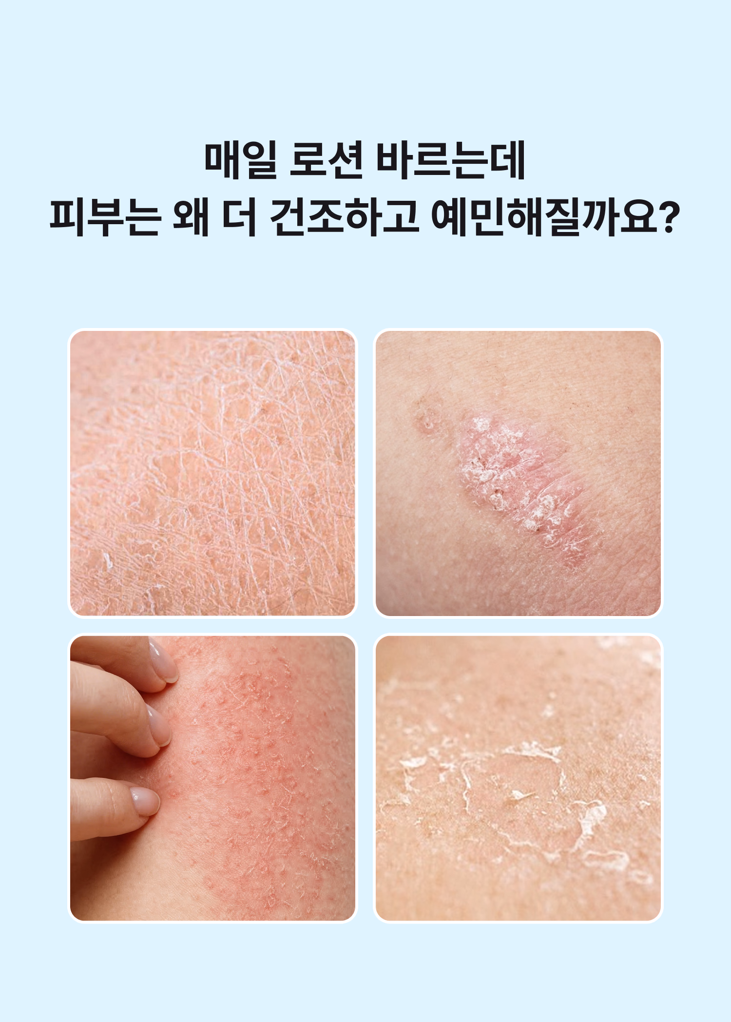 시오네 세라마이드 글로이 바디로션