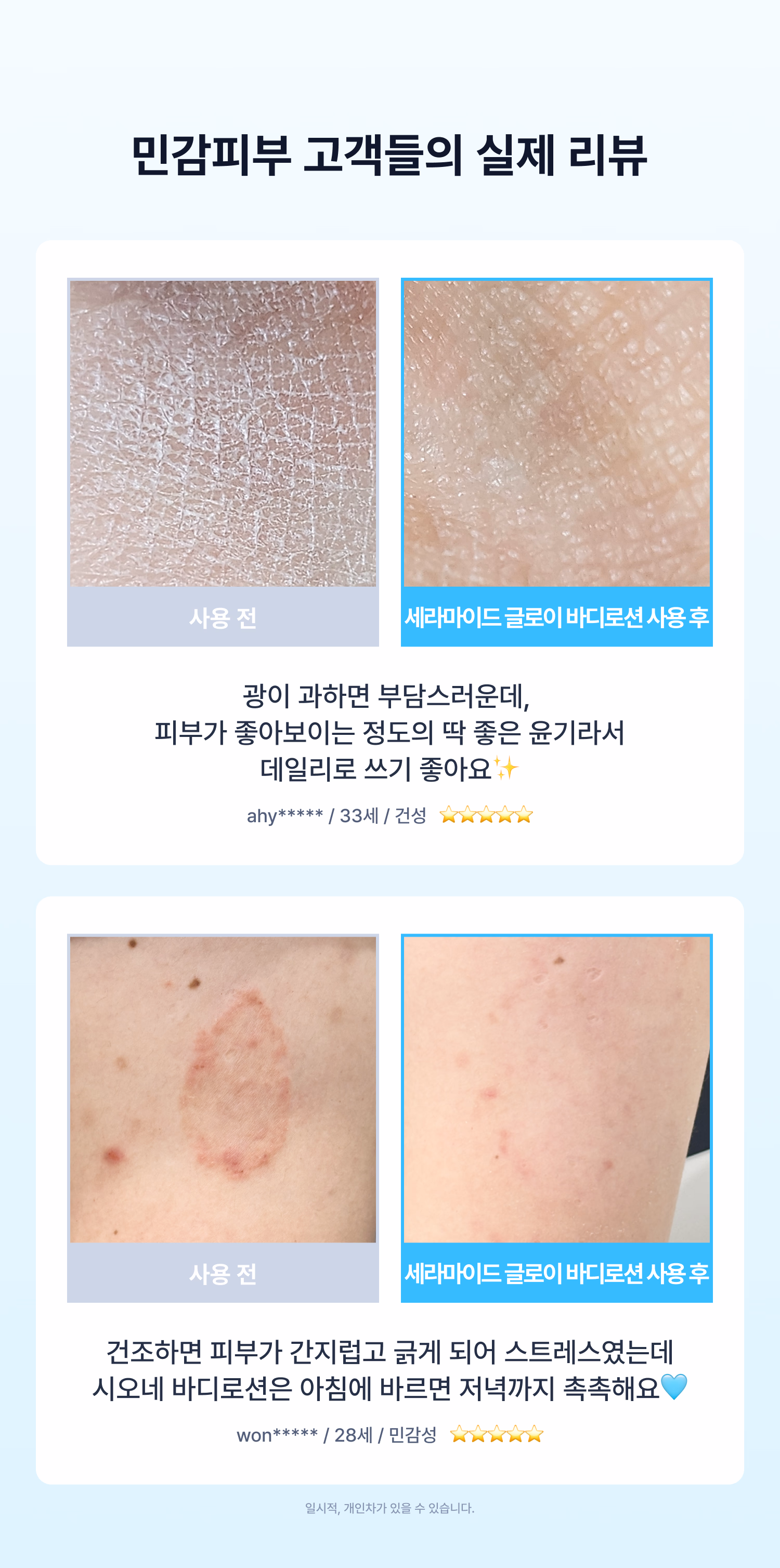 시오네 세라마이드 글로이 바디로션