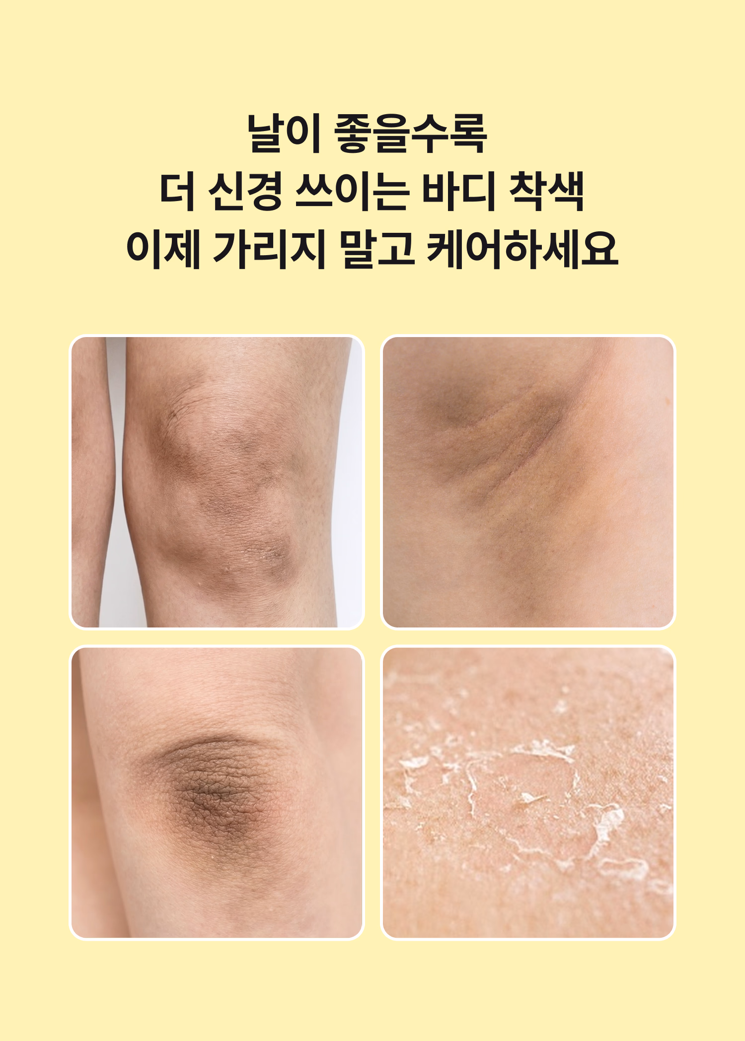 시오네 레티타놀 턴오버 바디세럼