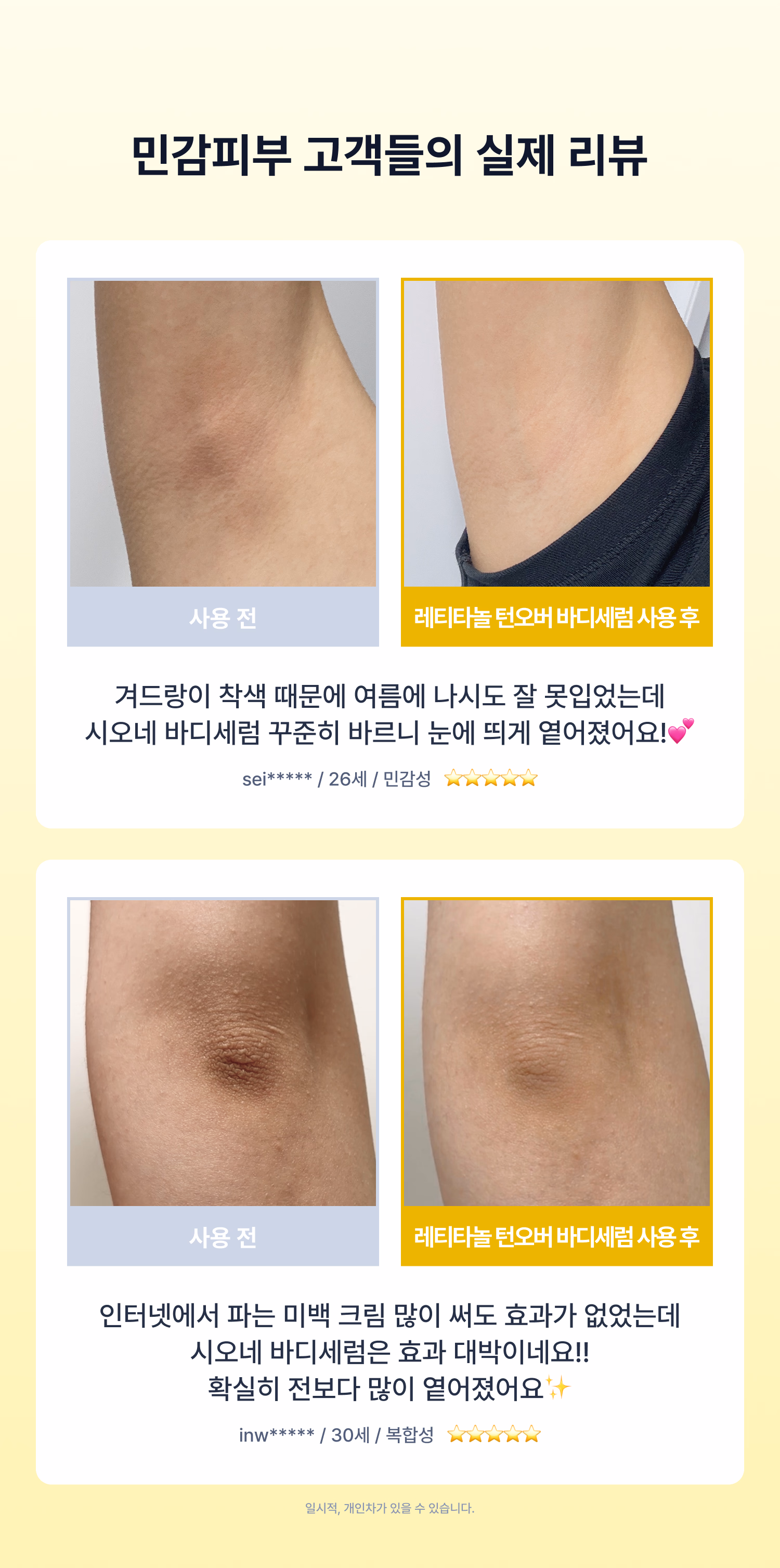 시오네 레티타놀 턴오버 바디세럼