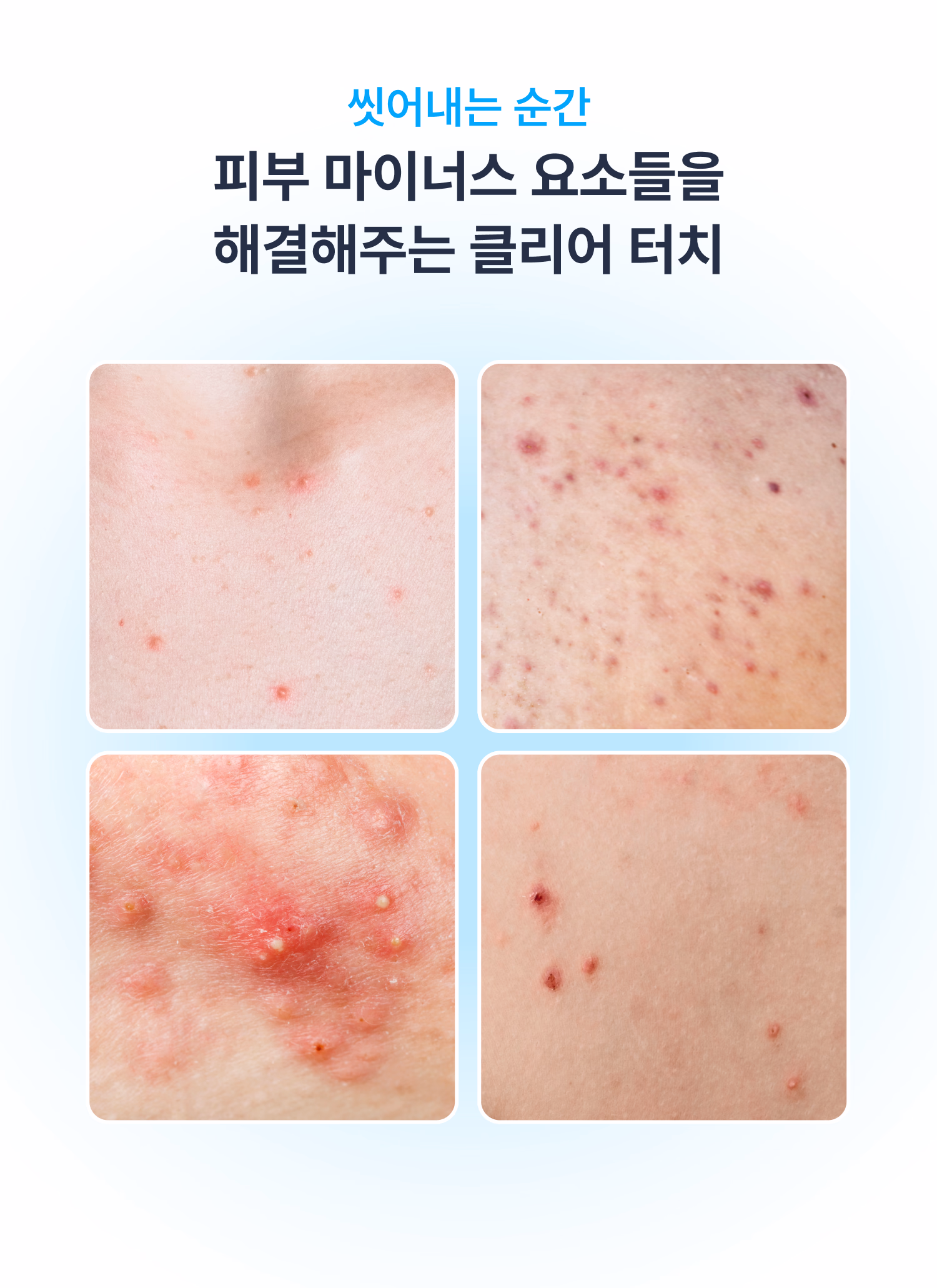 시오네 릴리프 바디케어 세트