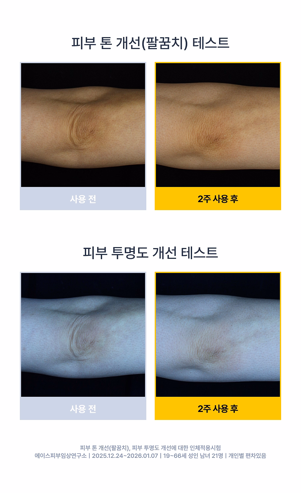 시오네 릴리프 바디케어 세트