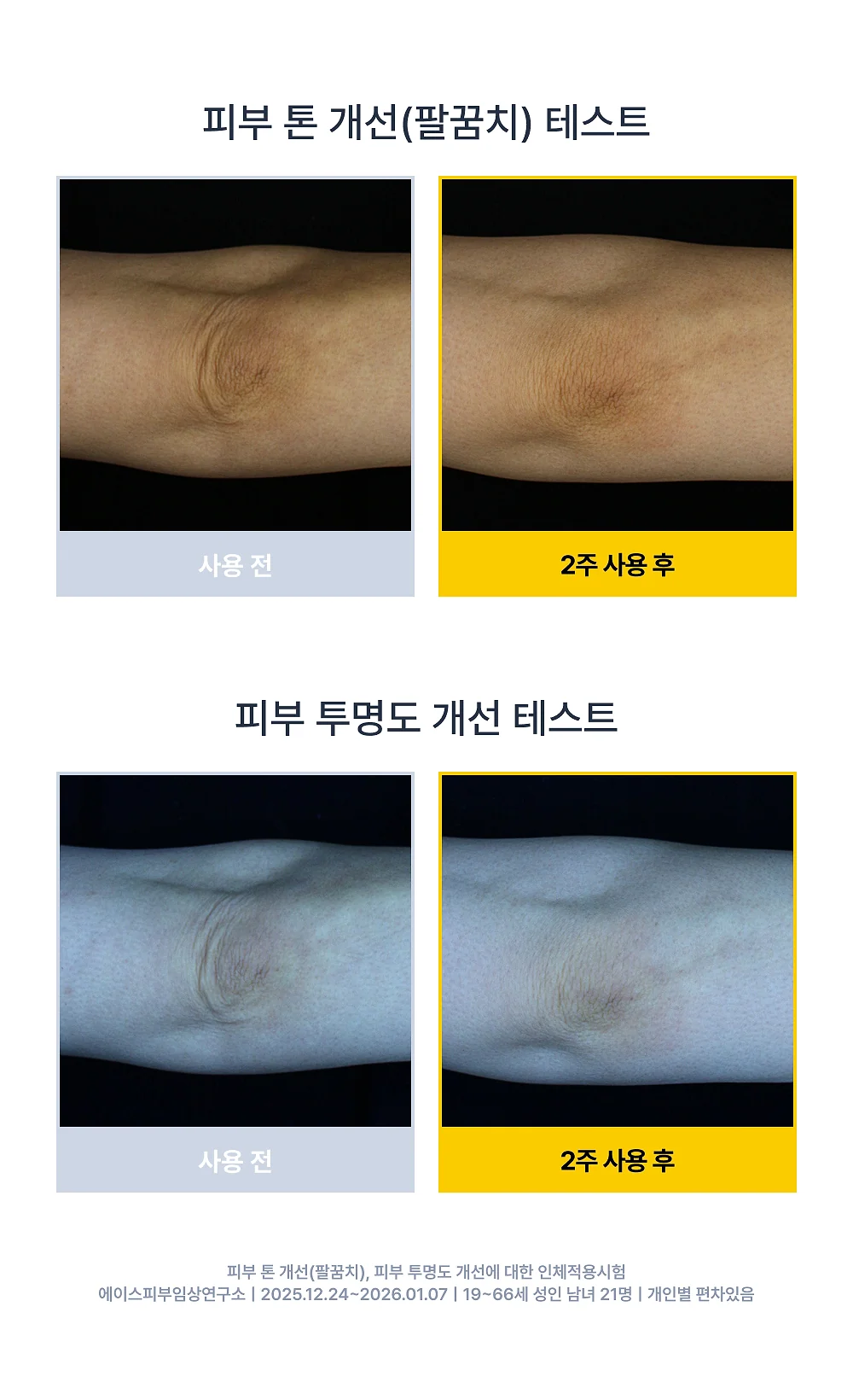 시오네 릴리프 바디케어 세트