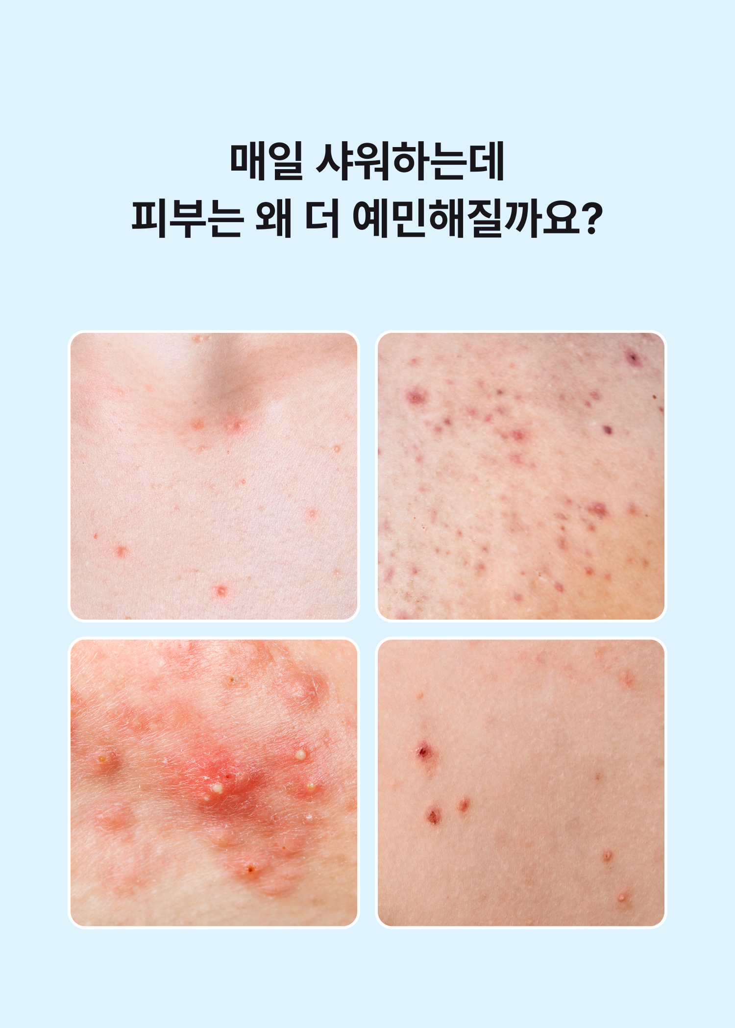 시오네 릴리프 바디케어 세트