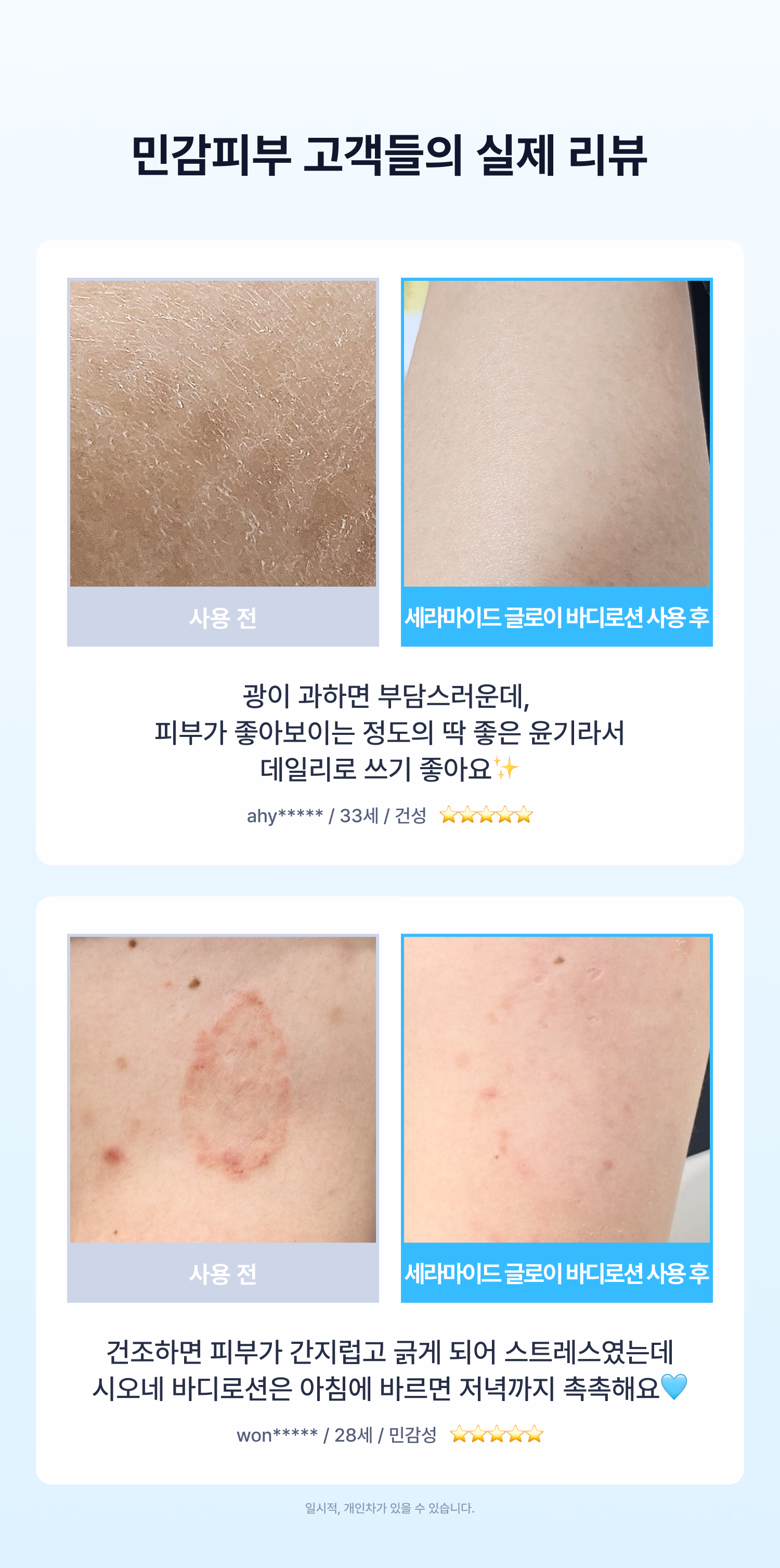시오네 릴리프 바디케어 세트