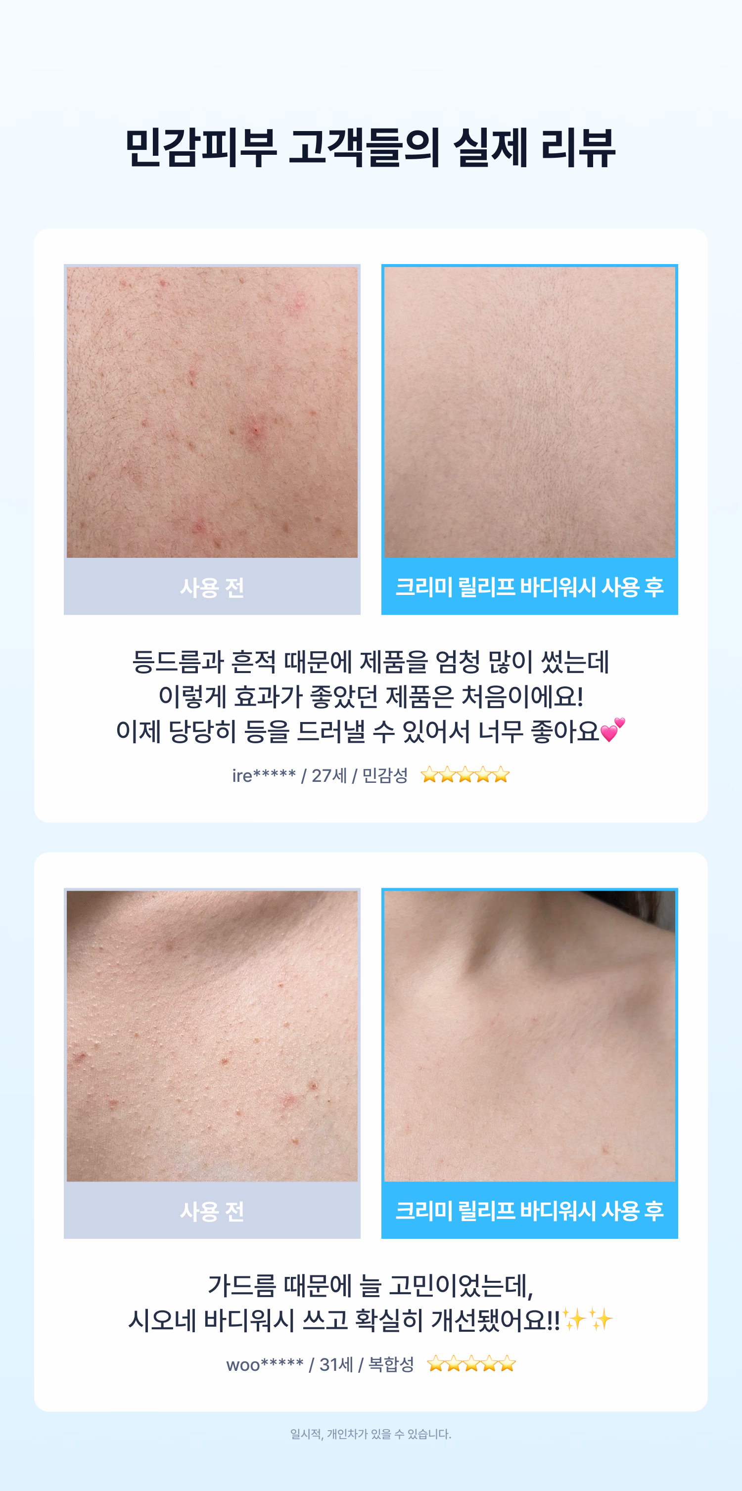 시오네 릴리프 바디케어 세트