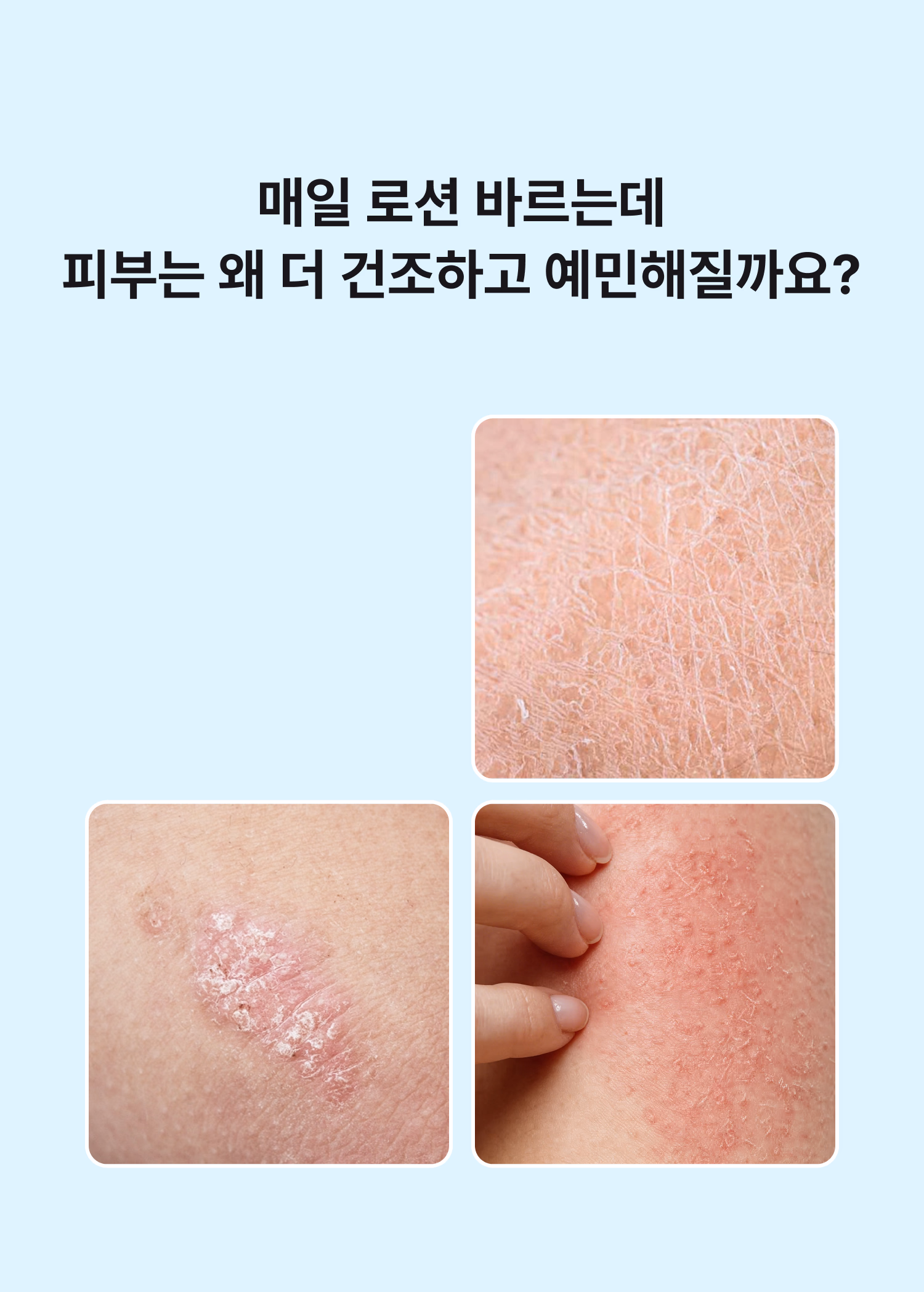 시오네 릴리프 바디케어 세트
