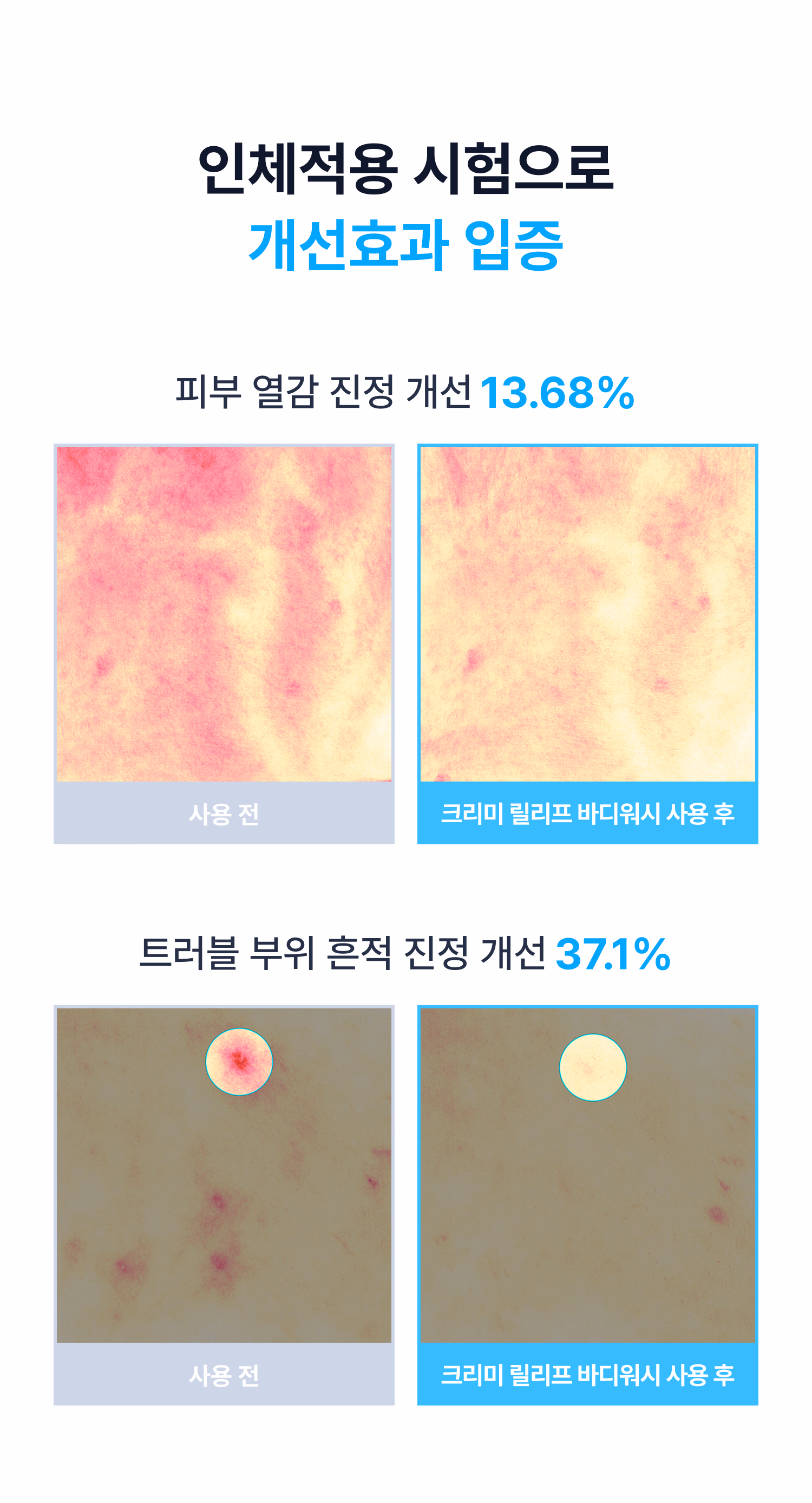 시오네 릴리프 바디케어 세트